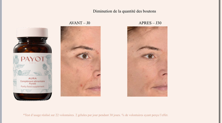 AURA Voedingssupplement Pureté: voor vette/ gemende huid en acné